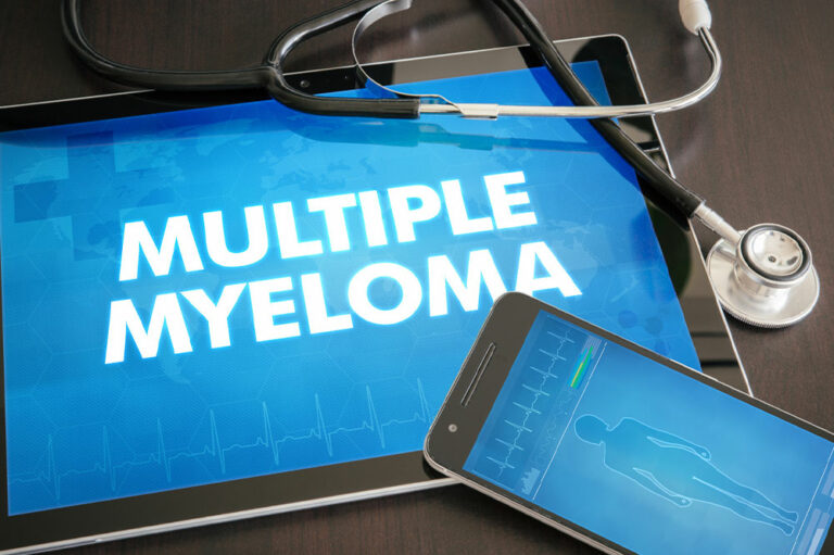 Multiple Myeloma – Unusual Signs and Management